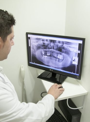 x-ray of the jaw, mandible, odontology-2416944.jpg